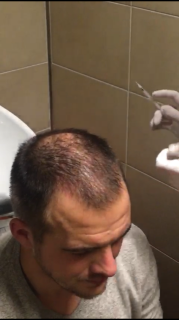 Nico voor de behandeling